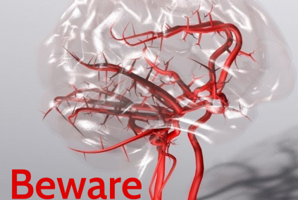 Beware=-of-silent0-stroke-jsbconference-com